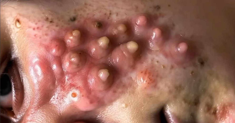 SERIOUS Diseases Diagnosed Via Skin Signals!